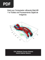 Vision Por Computador Utilizando MatLAB