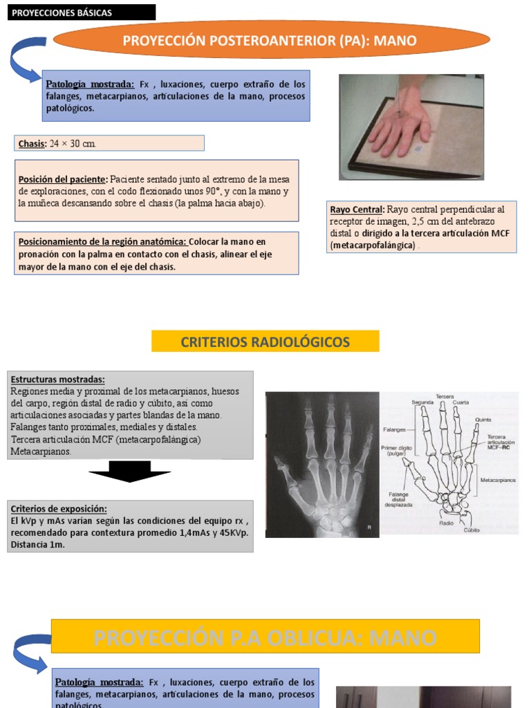Proyecciones Radiológicas de Mano | PDF | Mano | Sistema esquelético
