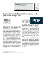 Surgical Treatment of Dermatofibrosarcoma Protubera 2017 Journal of Dental S