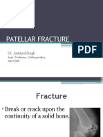 Patellar Fracture Rehab and Treatment