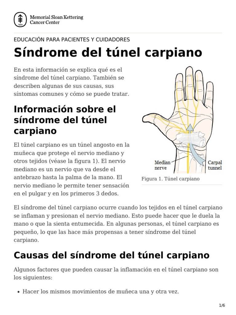 Síndrome Del Túnel Carpiano Care Guide Information En Espanol