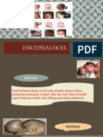 Encephalocel