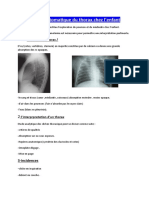 Rappel Automatique Du Thorax Chez L