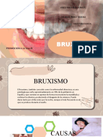 BRUXISMO