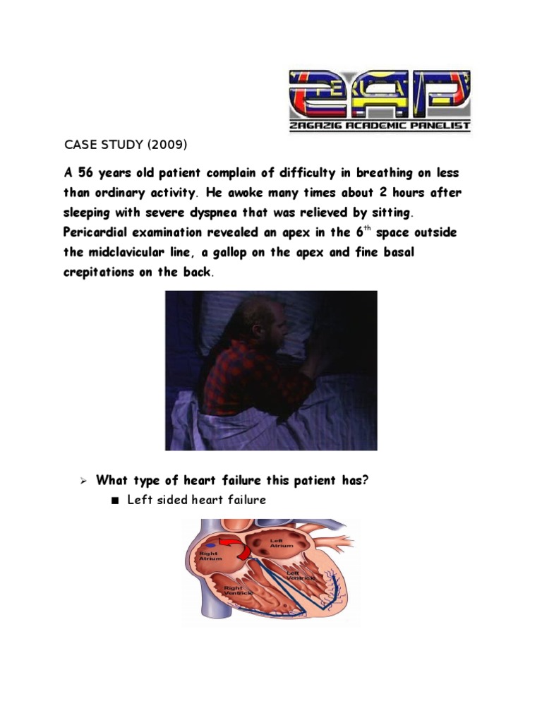 CASE STUDYHeart Failure PDF