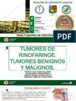 Presentacion Tema 3 Tumores de La Rinofaringe