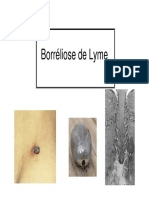 Borreliose de Lyme Juin 2012