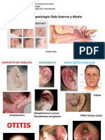 Fisiopatología del oído externo y medio