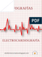 Infografias ECG