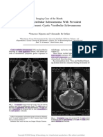 Imaging of Vestibular Schwannoma With Prevalent Cystic Component Cystic Vestibular Schwannoma