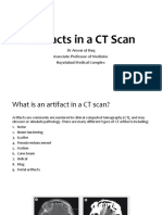 Artifacts in A CT Scan