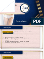 Palatoplastia (1)