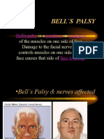 (3.4) Bell's Palsy