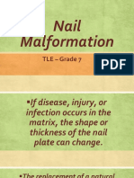 Nail Malformation Grade 8