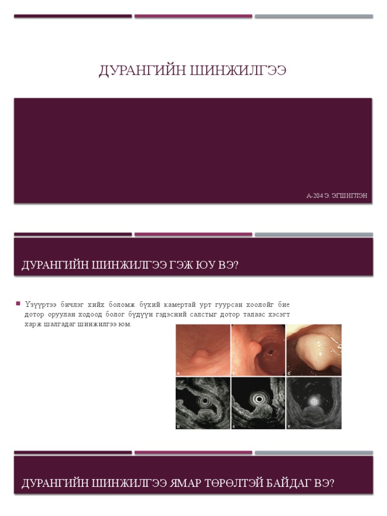 Дурангийн шинжилгээ | PDF