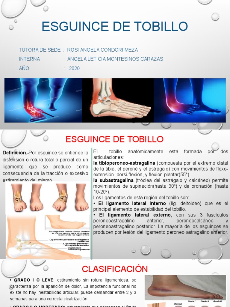 Esguince de Tobillo | PDF | Tobillo | Sistema musculoesquelético