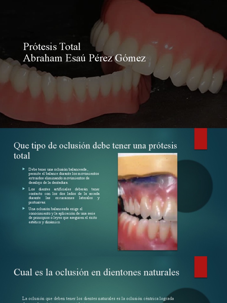 Oclusión Balanceada en Prótesis Total | PDF | Salud y bienestar