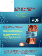 Rehabilitaion of Maxilofacial Case