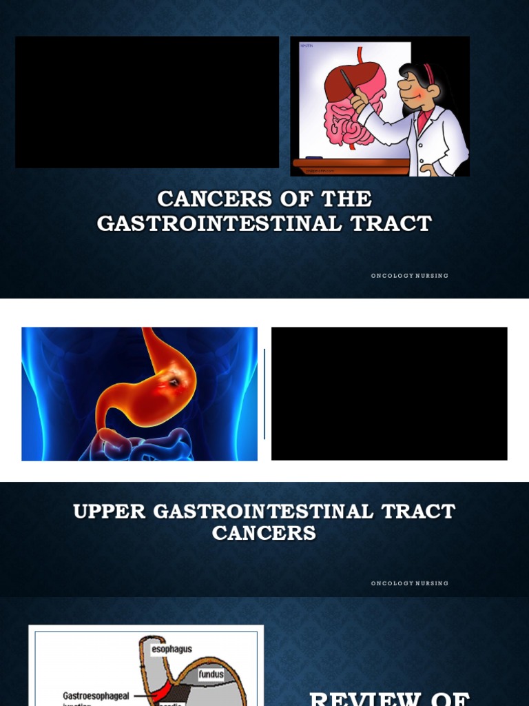 Upper Gi Cancer | Download Free PDF | Endoscopy | Gastroesophageal ...
