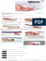 Internal Heart Monitoring - Google Search