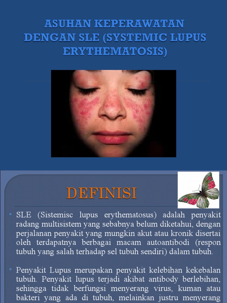 Sle Standard Therapy Interventions