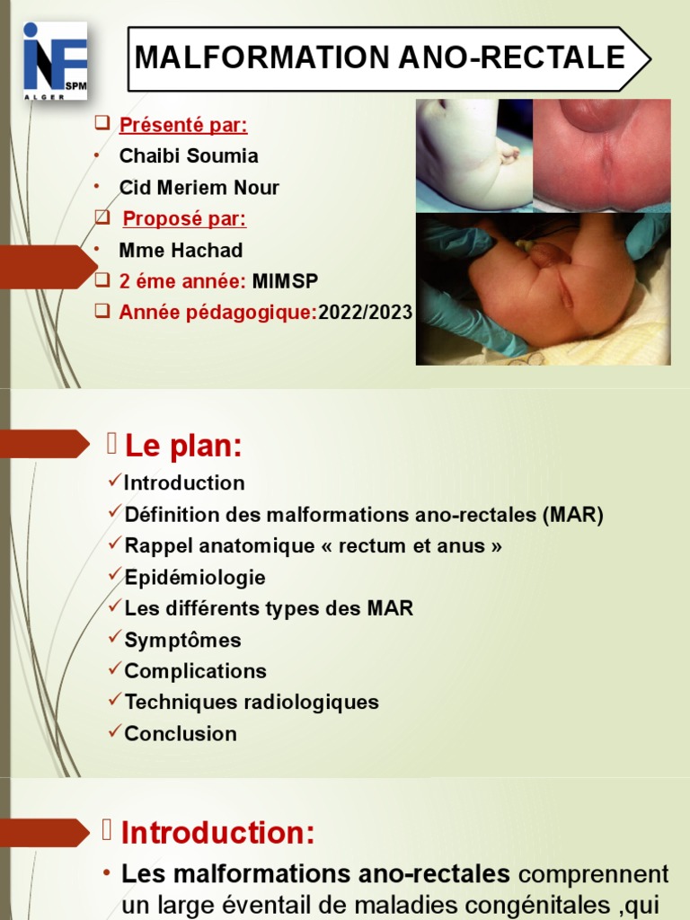 Malformation Ano Rectale Download Free PDF Rectum Gastroentérologie — free download