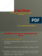 Interpretacion de RX Torax para Estudiantes UDENAR