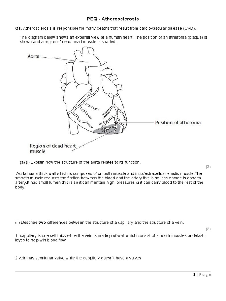 Atherosclerosis Edexcel Done | PDF | Atherosclerosis | Artery