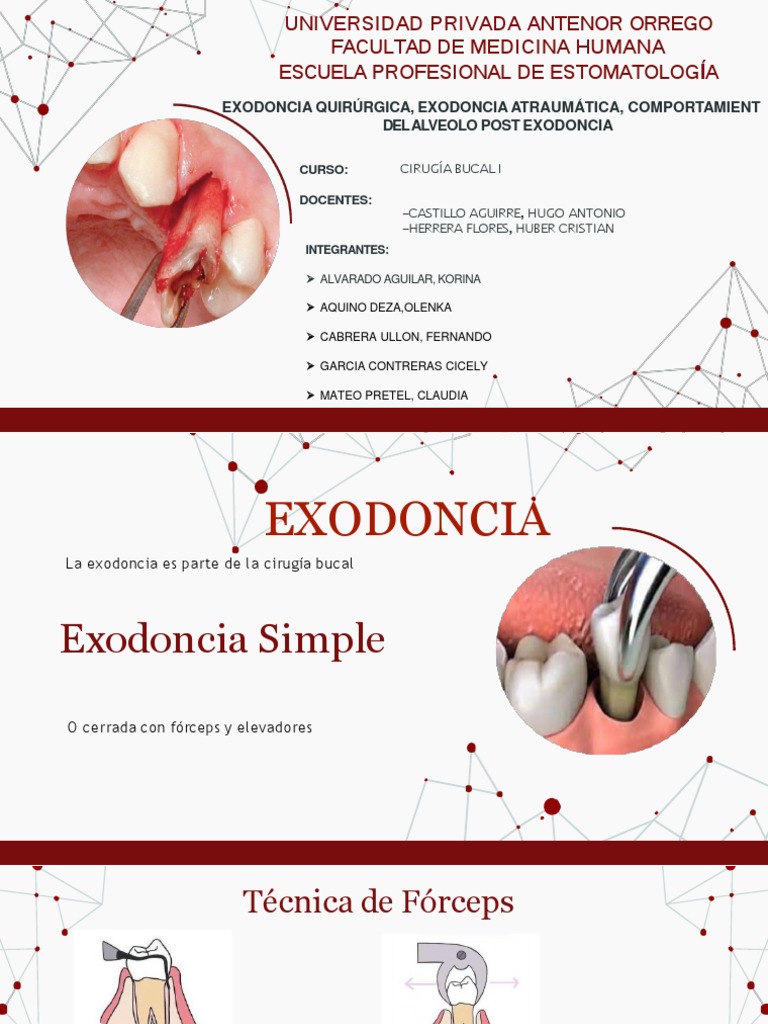Pasos de Exodoncia Quirúrgica | PDF | Odontología | Medicina CLINICA