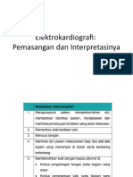 Elektrokardiografi: Pemasangan Dan Interpretasinya