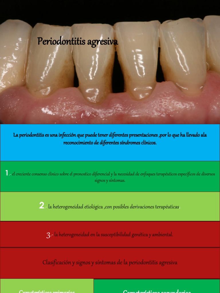 Periodontitis Agresiva: Diagnóstico y Tratamiento | PDF | Inmunología ...