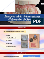 Elaboracion de Rodetes