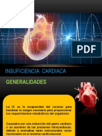 Insuficiencia Cardiaca