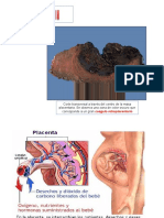 Corte transversal placenta hematoma retroplacentario