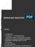 Zonular Dialysis