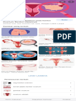 Kanker Ovarium - Google Penelusuran