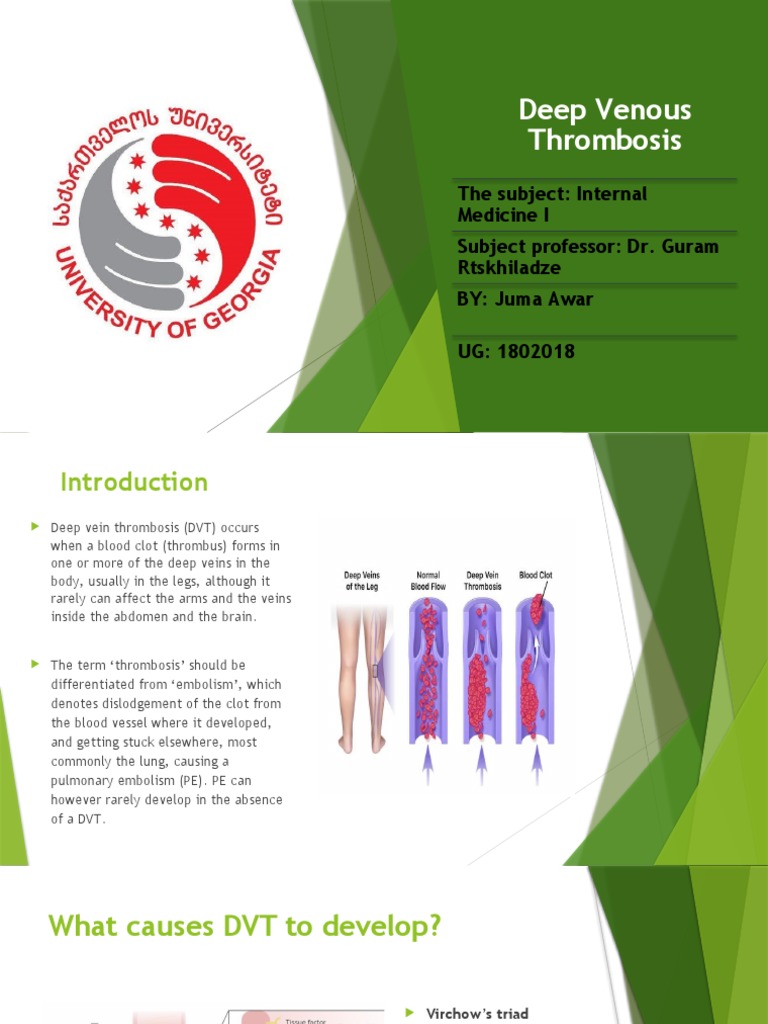 Deep Venous Thrombosis & Pulmonary Embolism PDF Thrombosis Thrombus