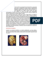 Histopatologia Del Carcinoma de Celulas Grandes