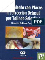 Tratamiento Con Placas y Corrección Oclusal Por Tallado Selectivo de Rubiano