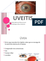 Uveitis