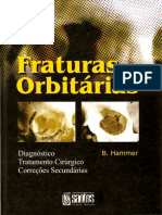 Hammer Orbital Fractures Portuguese