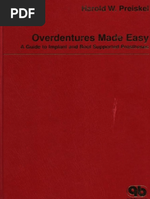 【洋書】Overdentures Made Easy: A Guide to Overdentures Made Easy | PDF