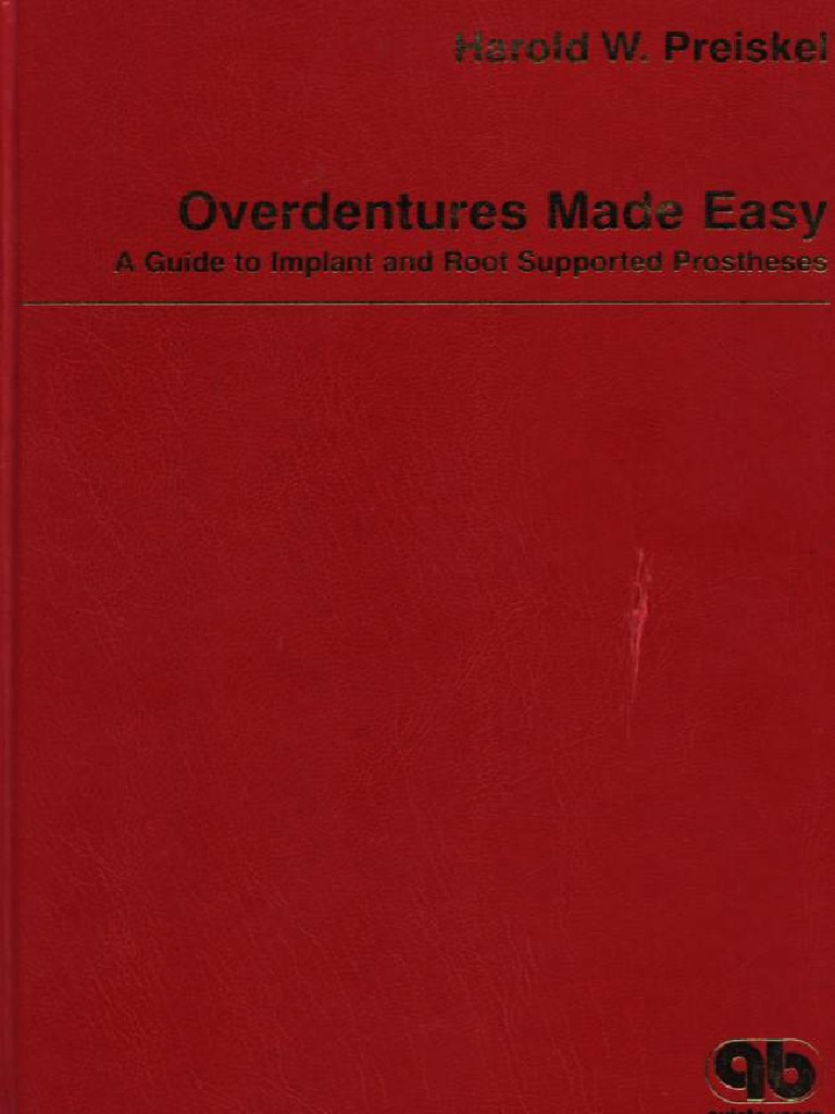 【洋書】Overdentures Made Easy: A Guide to Overdentures Made Easy: A Guide to Implant and Root
