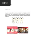 Download Inlay Dan Onlay by Iwan Baharum SN61586944 doc pdf