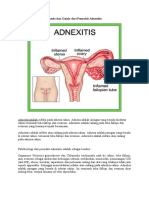 Tanda Dan Gejala Dari Penyakit Adnexitis