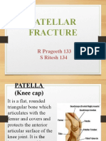 Patellar Fracture Treatment and Classification