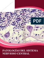 Patologías Del SNC