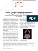 10.1016@j.prosdent.2016.01.004.PdfAdaptation of An Interim Partial Removable Dental Prosthesis As A Radiographic Template For Implant Placement