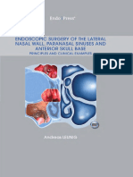 Endoscopic Surgery of The Lateral Nasal Wall, Paranasal Sinuses, and Anterior Skull Base (PDFDrive)