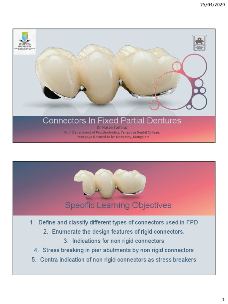 Connectors in Fixed Partial Dentures Final PDF Dental Implant